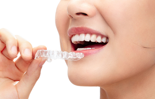 マウスピース矯正の画像