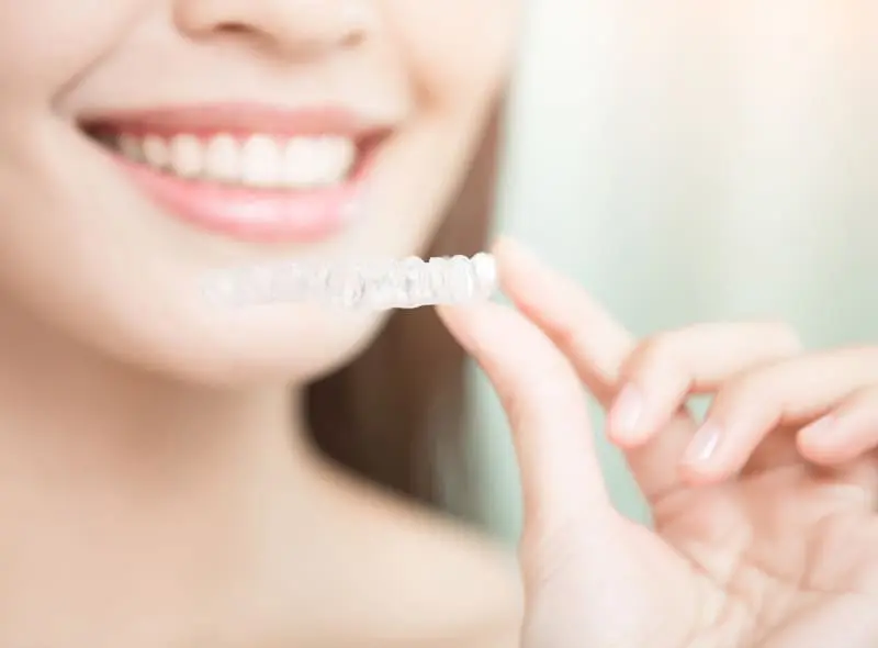 マウスピース矯正の画像