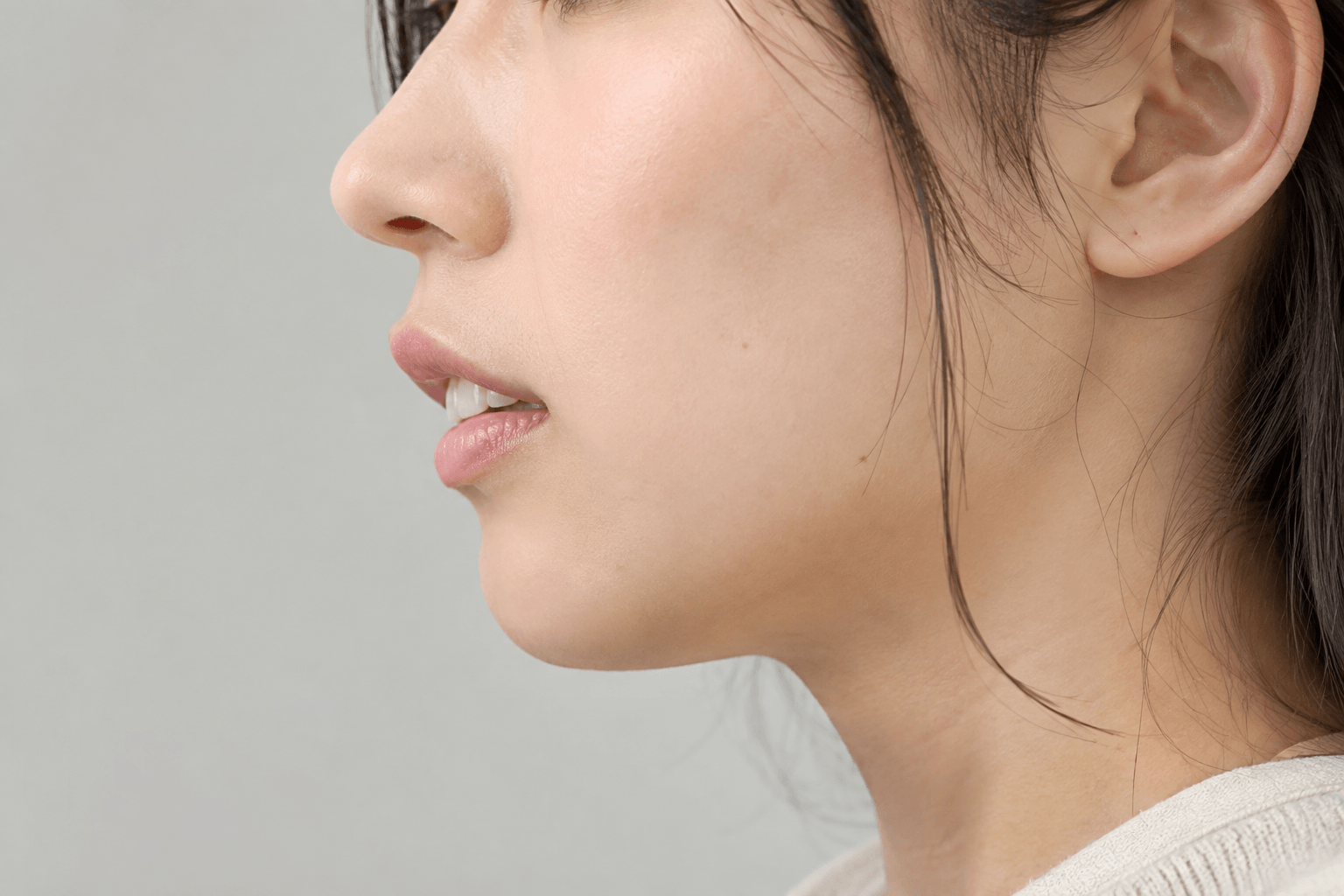 出っ歯（上顎前突）の状態をイメージした写真